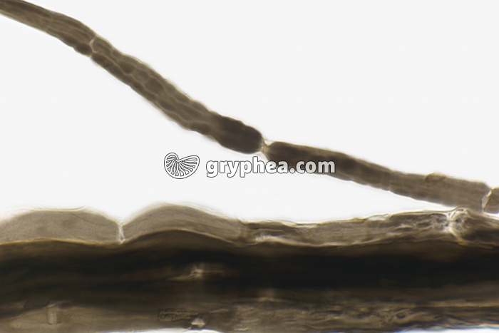 Noeud de Ranvier Nerf AO dissociation x200 - gryphea.com